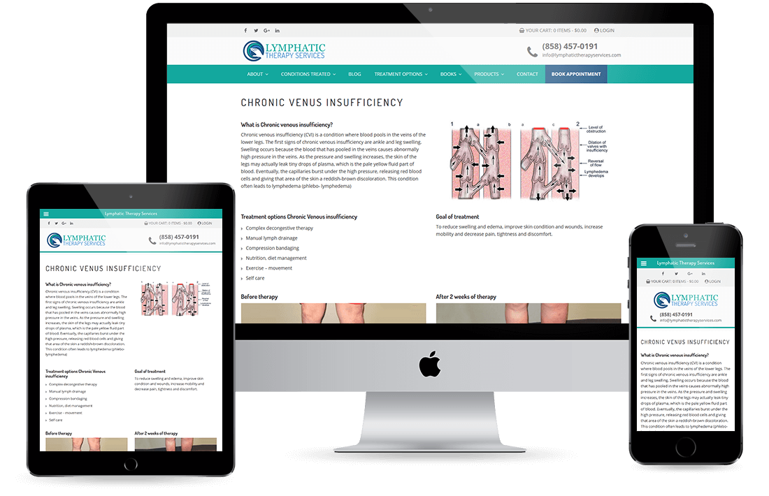 Lymphatic Therapy Services Service Page design by Equity Web Solutions